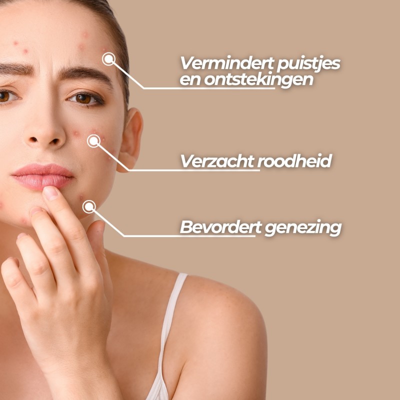 Anti-Acne Gezichtscrème - 50ml