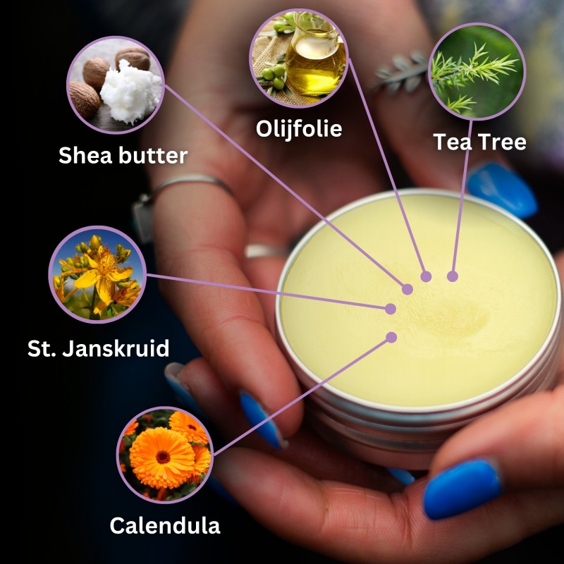 Brand- en Wondzalf met Calendula - 40ml