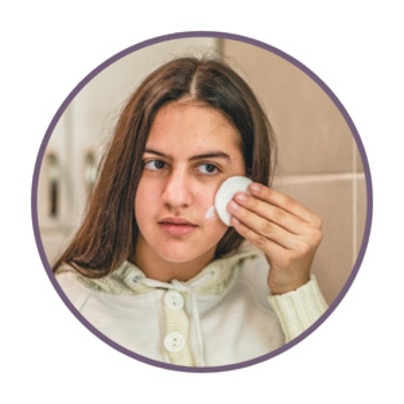 Crèmes tegen acne