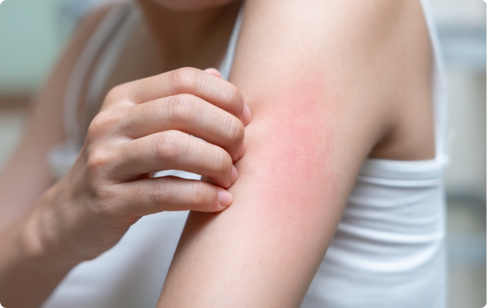 Als verzachtende olie voor de gevoelige of geïrriteerde huid