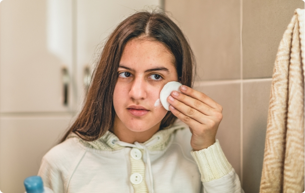 Als tonicum voor acne en irritaties