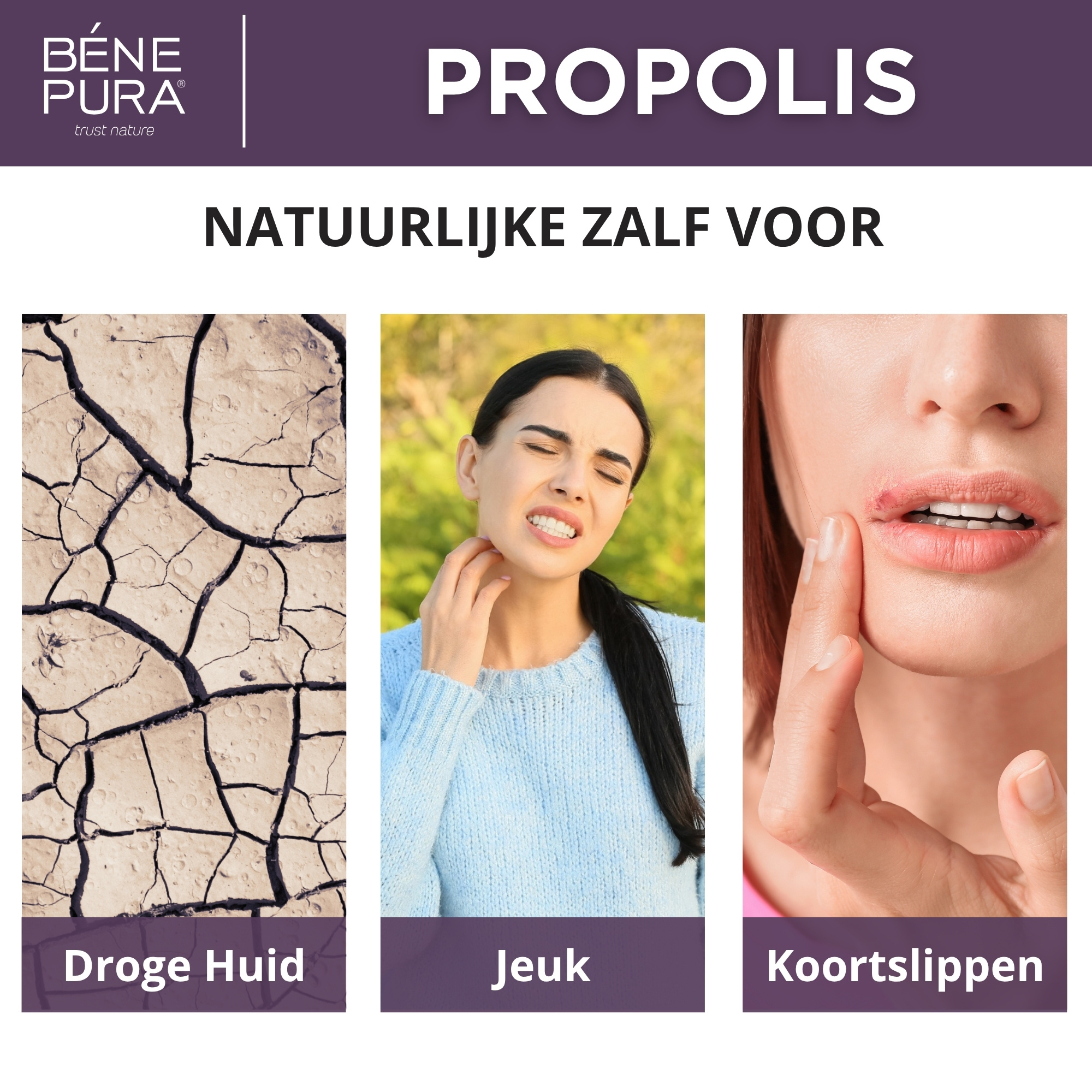 "Zalven voor Jeuk" Set