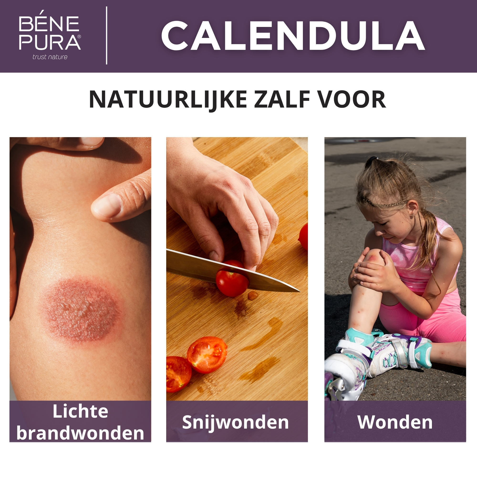 Brand- en Wondzalf met Calendula, Aloë Vera en St. Janskruid - 40ml